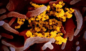 A transmission electron microscope image shows SARS-CoV-2, the virus that causes COVID-19.