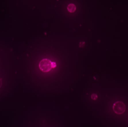 Red cells on a black background