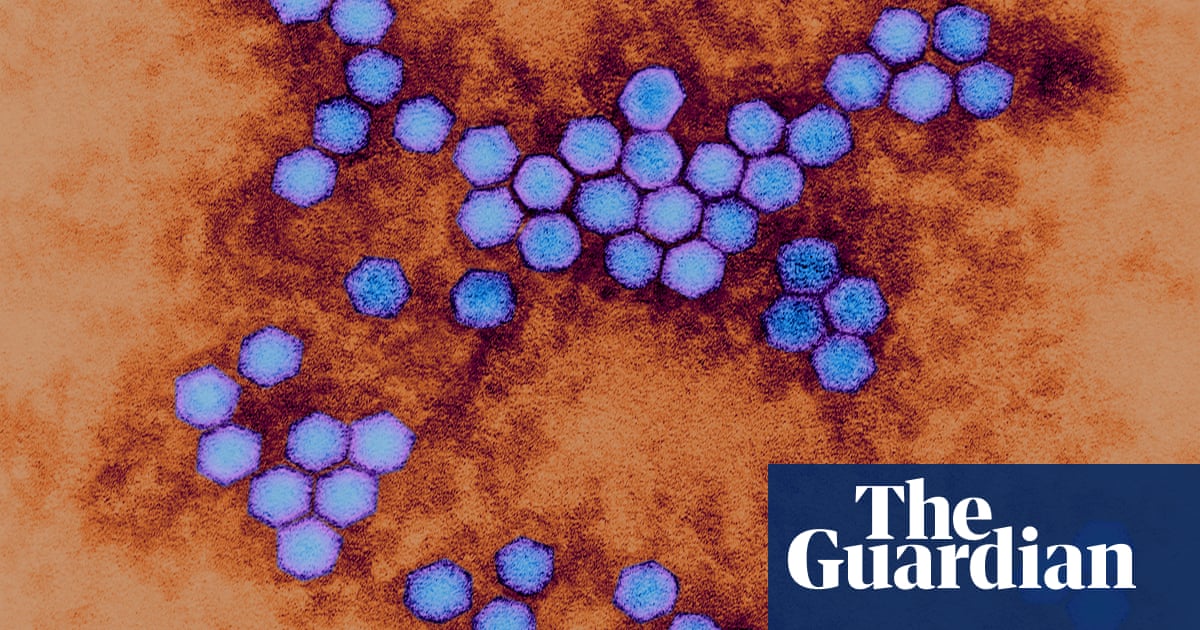 Man Found To Have Been Shedding Virulent Strain Of Polio For 30