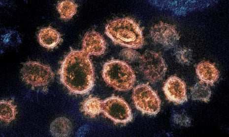 An electron microscope image shows Sars-Cov-2 virus particles emerging from the surface of cells cultured in a lab. 