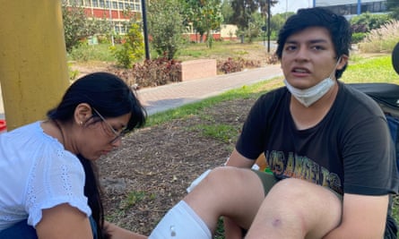 Esteban Godofredo, um estudante, está sendo tratado por uma lesão na perna