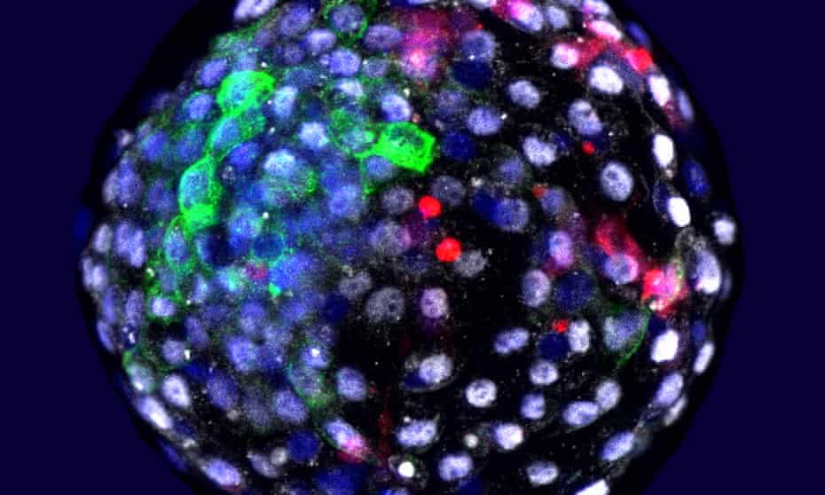 A photo issued by the Salk Institute shows human cells grown in an early stage monkey embryo