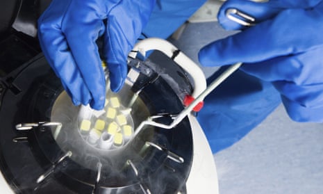 Embryo samples being removed from cryogenic storage.