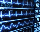 ‘Superhuman’ AI tool spots heart disease in less than 2 seconds