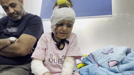 Hanin al-Wadie, five, sits with a bandaged head and arms next to a man