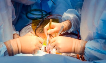 Heart surgery operation