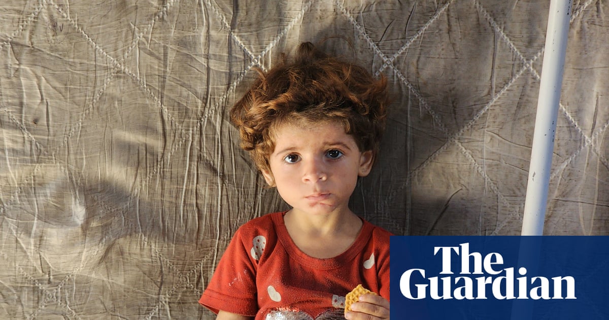 ‘Very sick and very tired’: the reality of famine for Gaza’s most vulnerable