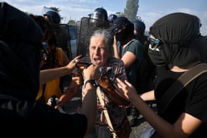 An elderly woman receives treatment for teargas
