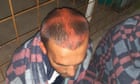 Croatian police accused of shaving and spray-painting heads of asylum seekers