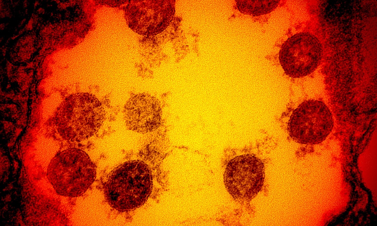 Covid discoveries: what we know now that we didn't know before | Coronavirus | The Guardian