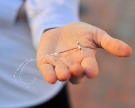 An IUD birth control coil device.