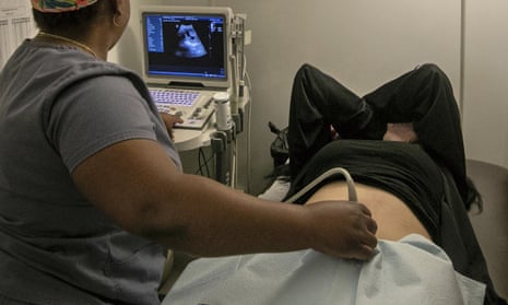 An operating room technician performs an ultrasound on a patient at an abortion clinic