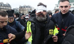Jérôme Rodrigues, one of the leaders of the gilets jaunes movement, is helped after being injured in the eye during clashes between protesters and riot police in Paris