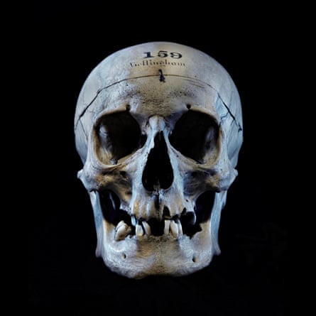 The skull of John Bellingham, the man who killed PM Spencer Perceval in 1812