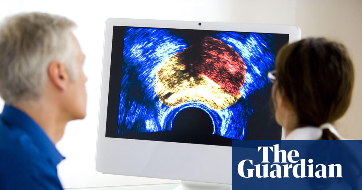 Expert Panel Urges Restraint in Prostate Cancer Screening, Emphasizing Individual Responsibility