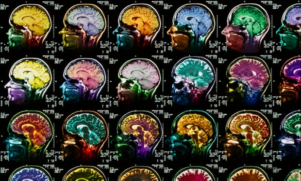 Brain scans