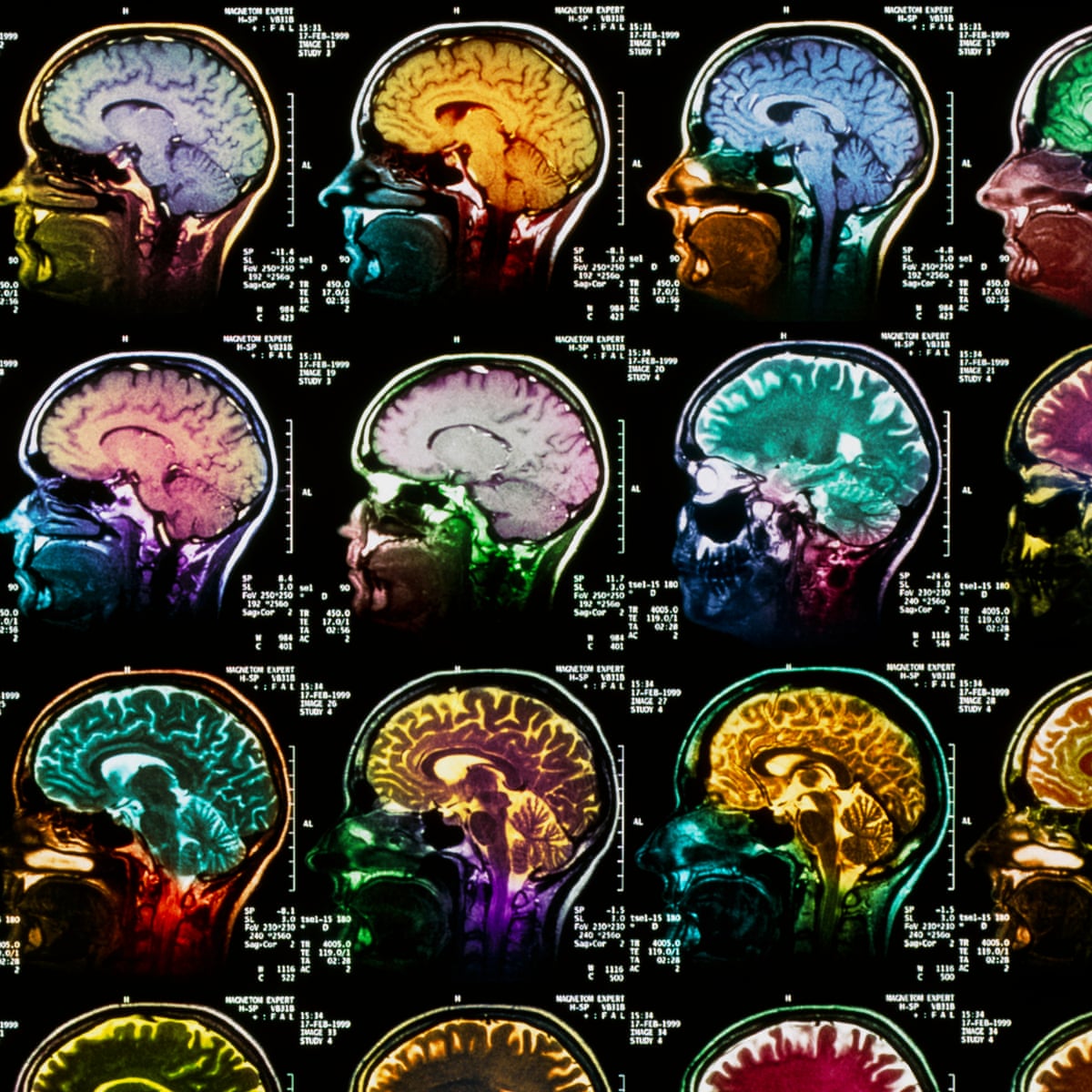 Scientists Identify Parts Of Brain Involved In Dreaming Neuroscience The Guardian