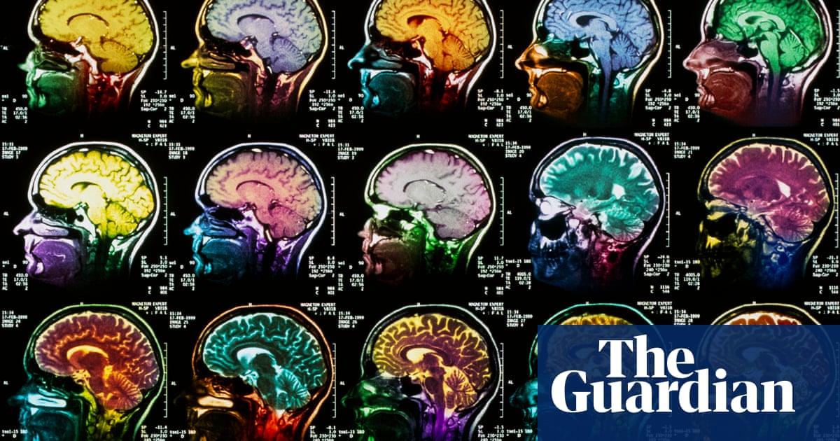 The Science Of Songs How Does Music Affect Your Body Chemistry