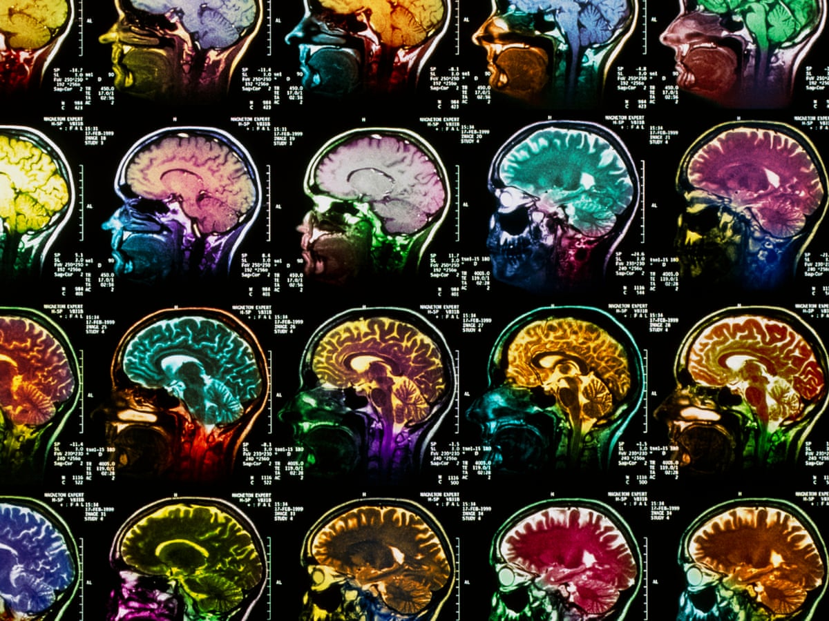 What Does Running Do To Your Brain Running The Guardian What Does Running Do To Your Brain Running The Guardian