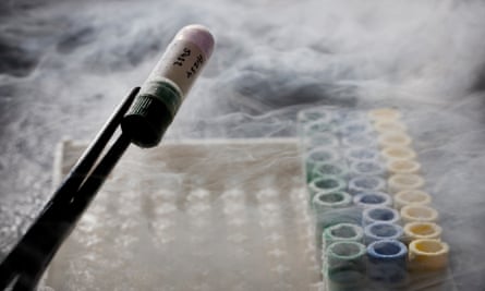 A vial of donor sperm frozen in liquid nitrogen.