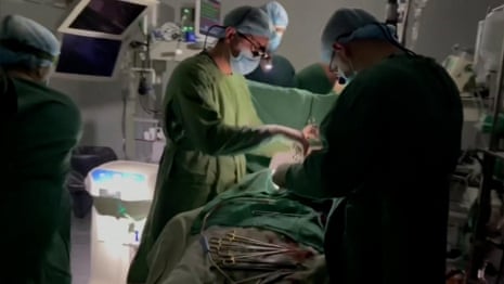 Kyiv surgeons perform heart surgery on child despite power cut – video