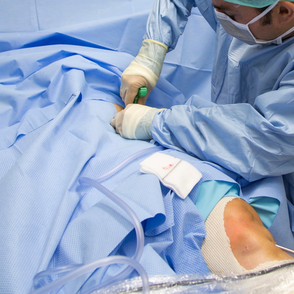 Obesity Putting Strain On Nhs As Weight Related Admissions