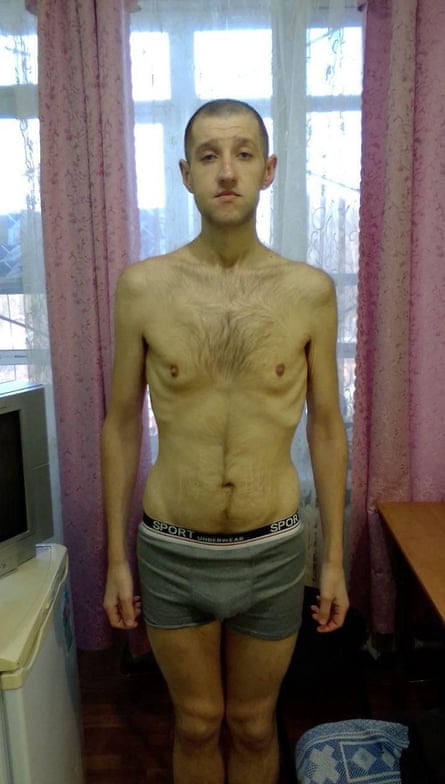 Yuri Merkotan lost nearly 60kg during his capture.