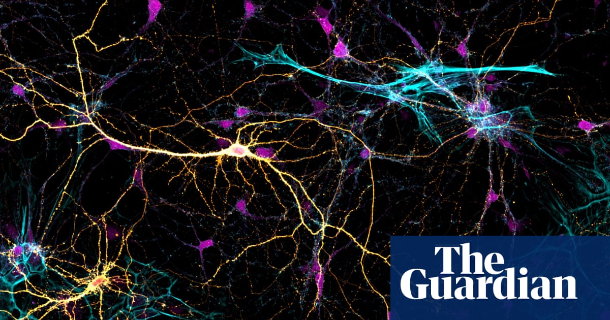 Zoom in: national science week prize puts photography under the microscope – in ..