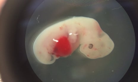 A 4-week-old pig embryo carrying human stem cells, an experiment led by Juan Carlos Izpisua Belmonte, who recently created the first human-monkey chimera.