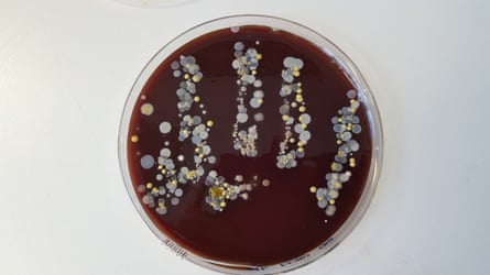 A blood agar plate showing colonies of bacteria after a student coughed into his hand and pressed it into the plate