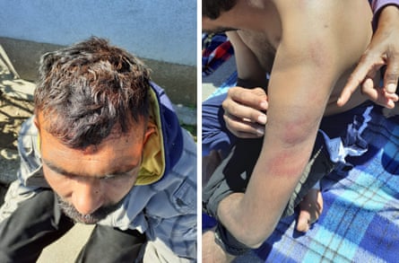 migrants spray painted by the Croatian police