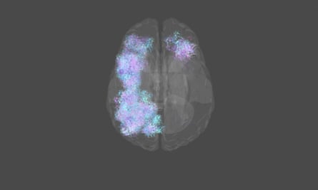 Imaging of Rich Pelley’s brain activity while playing Elden Ring.