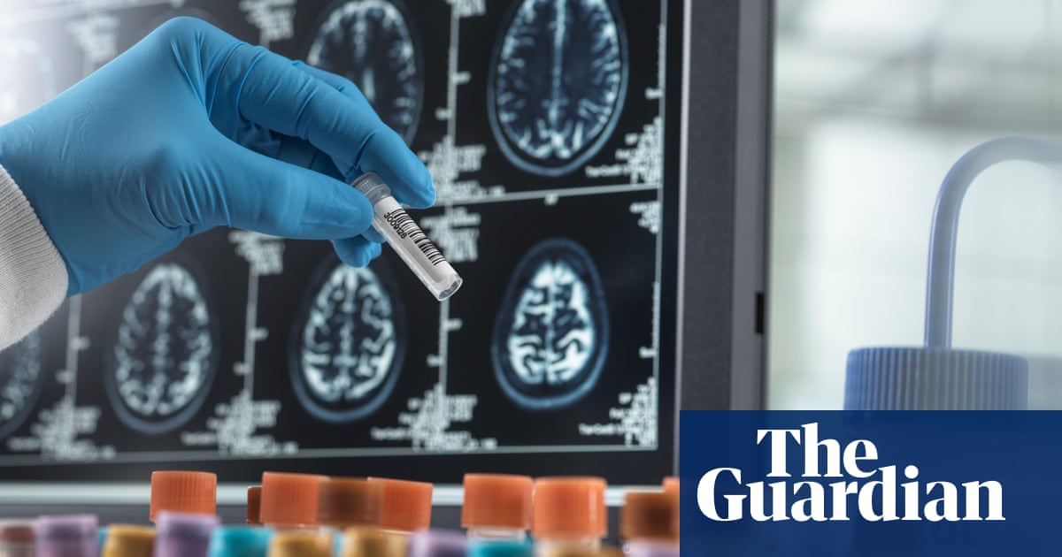 Doctored by Charles Piller review – the scandal that derailed Alzheimer’s research | Science and nature books Doctored by Charles Piller review – the scandal that derailed Alzheimer’s research | Science and nature books