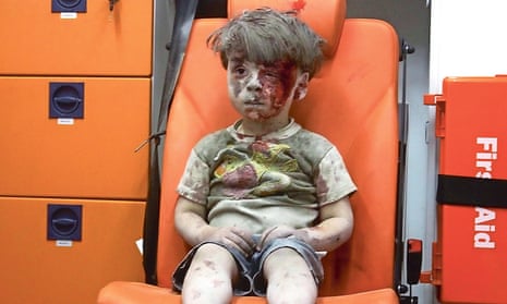 Five year-old Omran Daqneesh was injured last week in an airstrike on the Qaterji neighbourhood of Aleppo.