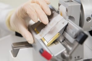Adele Lusson, research assistant, preparing paraffin embedded tissue sections for staining.