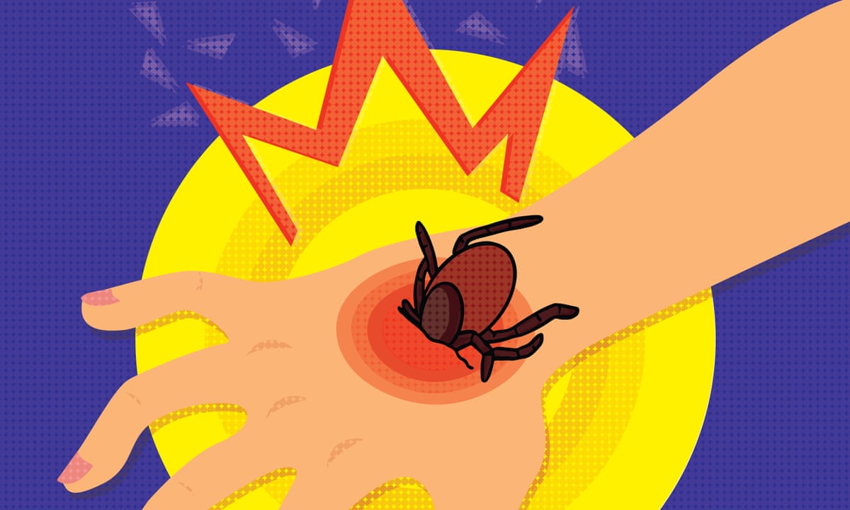 Lyme Disease Is A Solution On The Way Medical Research The Guardian Lyme Disease Is A Solution On The Way Medical Research The Guardian
