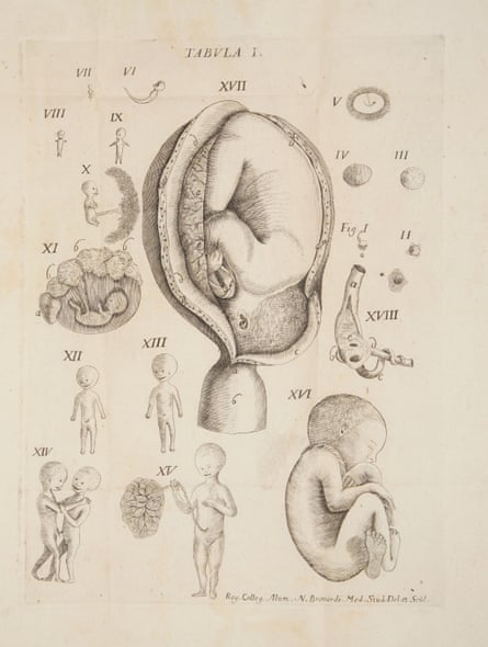Giovanni Baptista Bianchi’s stages of foetal development.