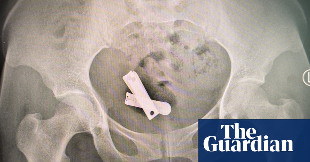 Rusted screws, metal spikes and plastic rubbish: the horrific sexual violence used against Tigray's women