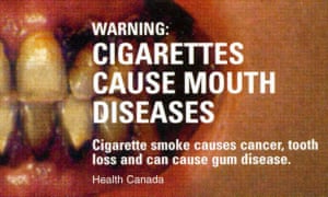 A Canadian anti-smoking warning