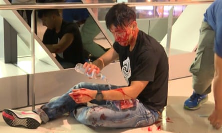 Journalist Ryan Lau Chun Kong tends to his wounds after he was attacked at Yuen Long mass transit station.