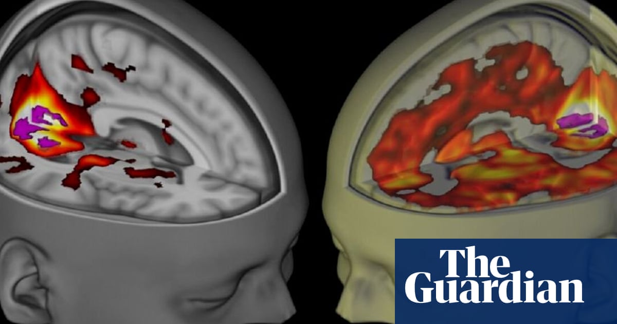 has a software bug really called decades of brain imaging research into question science the guardian has a software bug really called decades of brain imaging research into question science the guardian