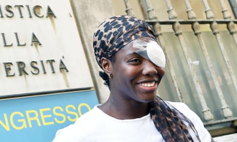 Daisy Osakue wears a patch over her eye after an assault