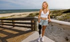 At 17, a shark attack cost me my leg. A year later, I'm back in the water where I almost died
