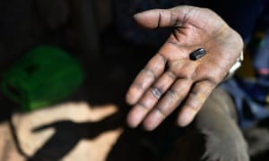 Esther Ewoi , a traditional snake-bite healer in Baringo county, Kenya, shows the black stone she uses to suck venom out of bites