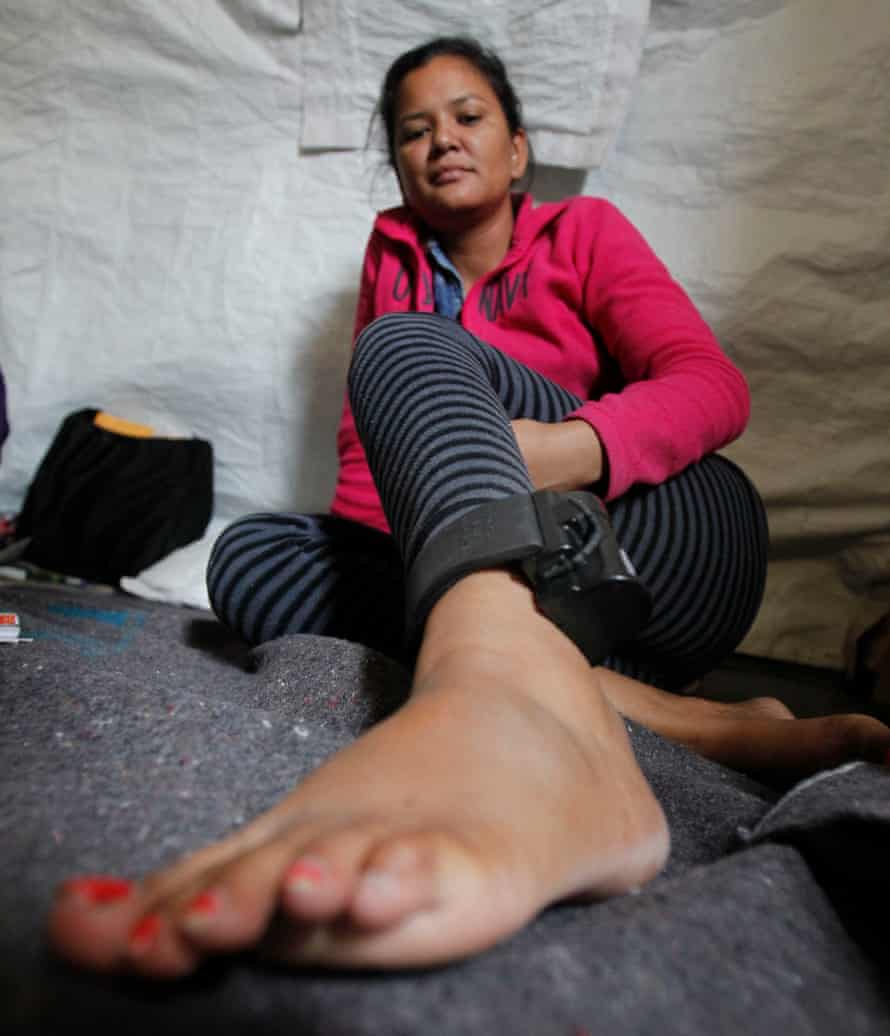 Jancy Acosta, an immigrant from Honduras, shows the surveillance bracelet that the Border Patrol put on her on November 8, 2016.