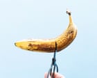 Rising vasectomy numbers in Australia show men's family planning shift