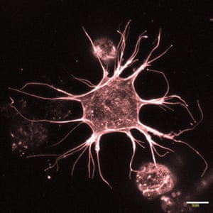 An osteocyte