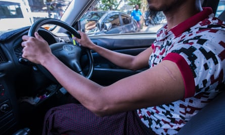 Myanmar Taxi driver Nanda Kyaw has scars on his left arm from a beating.