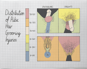 Wax On Wax Ouch Pubic Grooming Has A High Injury Rate Survey