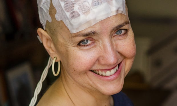 Jessica Morris wears an Optune which disrupts cancer cell division.